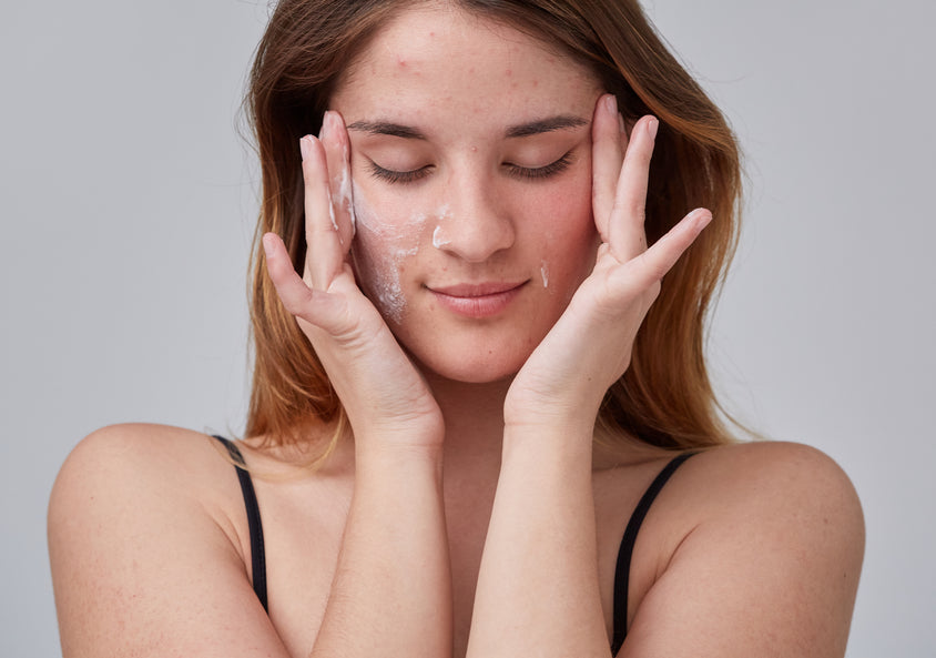 Medical grade skincare for Ance Available at Glow with Kate Beauty and Glow Beauty Bar